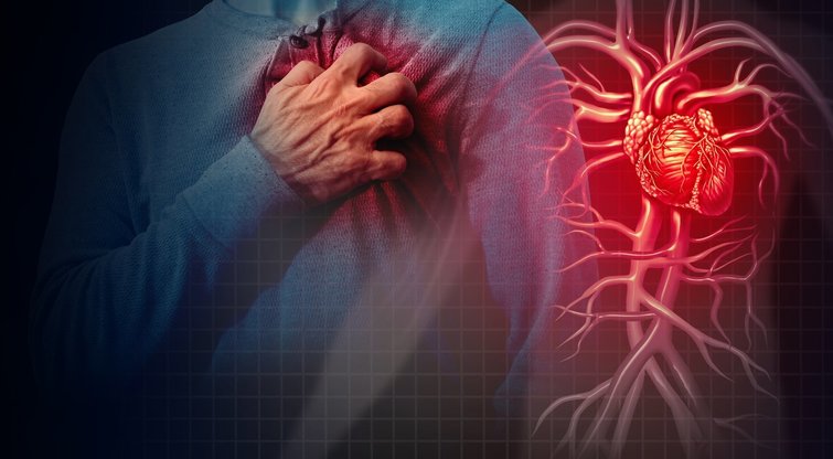 Širdies priepuolis, infarktas (Nuotr. 123rf.com)  