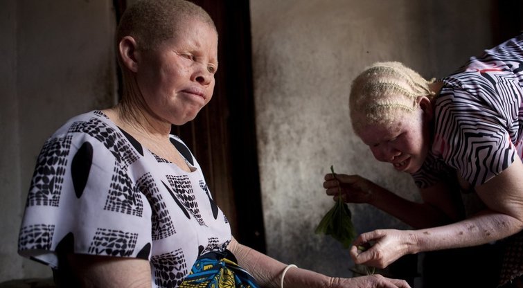 Albinosai įvairiose pasaulio šalyse  