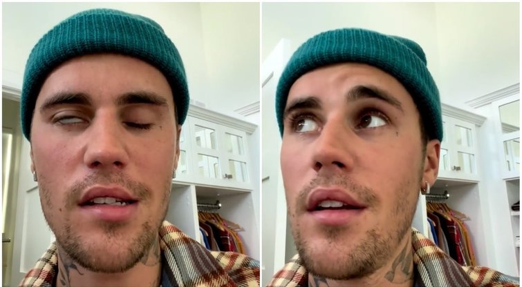 Atlikėją Justiną Bieberį ištiko veido paralyžius: skelbia atšaukiantis koncertus (nuotr. Instagram)