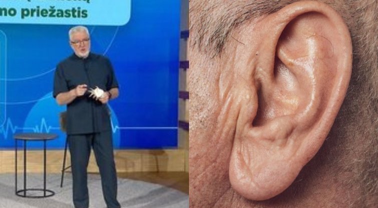Unikauskas atskleidė, kaip nustatyti artėjantį insultą: tereikia pažiūrėti į ausies spenelį  