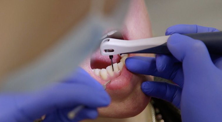 Tai žino ne visi: kada po dantų taisymo galima gauti nedarbingumą? (nuotr. stop kadras)