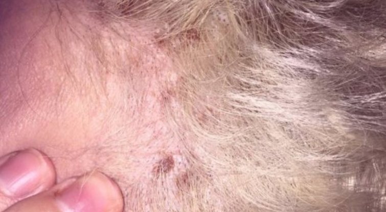 Moters siaubas kirpykloje: nudeginti plaukai ir sužalota galva (nuotr. facebook.com)