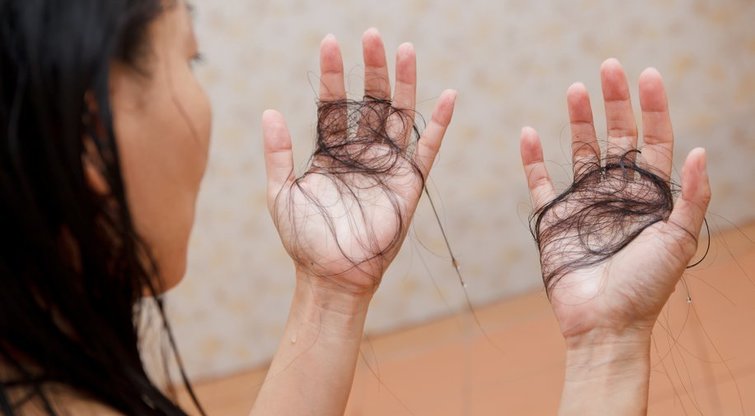 Plaukų slinkimas  (nuotr. Shutterstock.com)