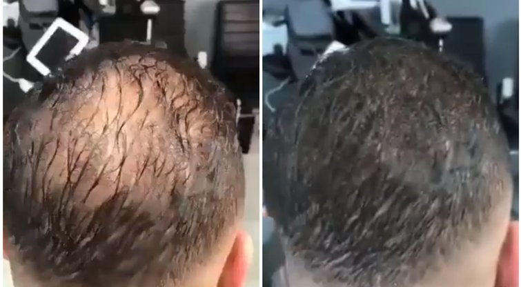 Tikras stebuklas plinkantiems vyrams: vešli šukuosena grįžta vos per minutę (nuotr. Instagram)