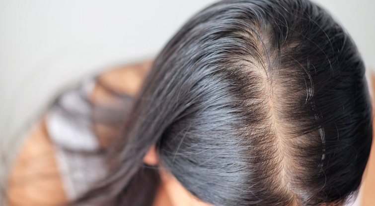 Pamirškite slenkančius plaukus: ragina išbandyti 1 produktą (nuotr. Shutterstock.com)
