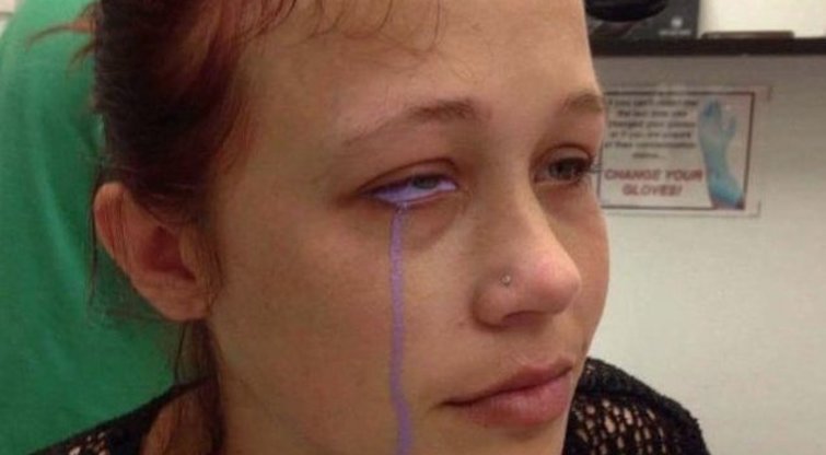 Mergina sugalvojo pasidaryti akies obuolio tatuiruotę, o baigėsi nebeištaisoma nelaime  