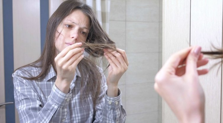 Silpni plaukai (nuotr. 123rf.com)