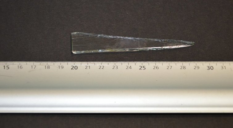 Iš moters kūno ištraukta stiklo šukė (nuotr. Policijos)
