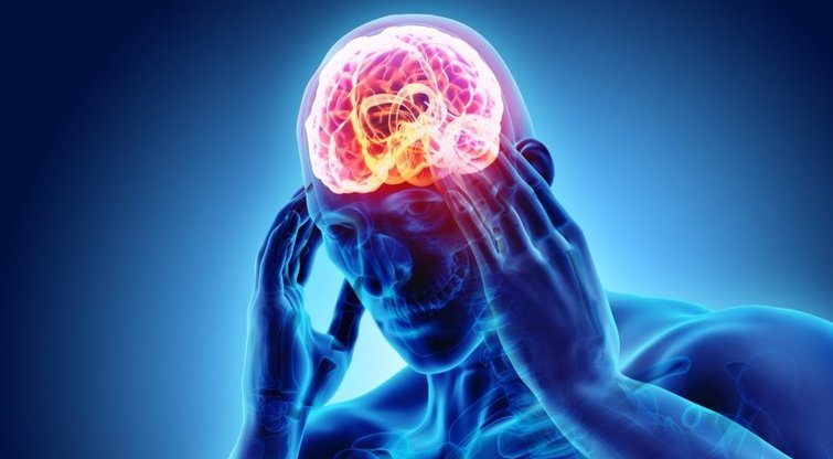 Atsibudote su skaudančia galva? Paaiškino, kodėl taip būna (nuotr. Shutterstock.com)