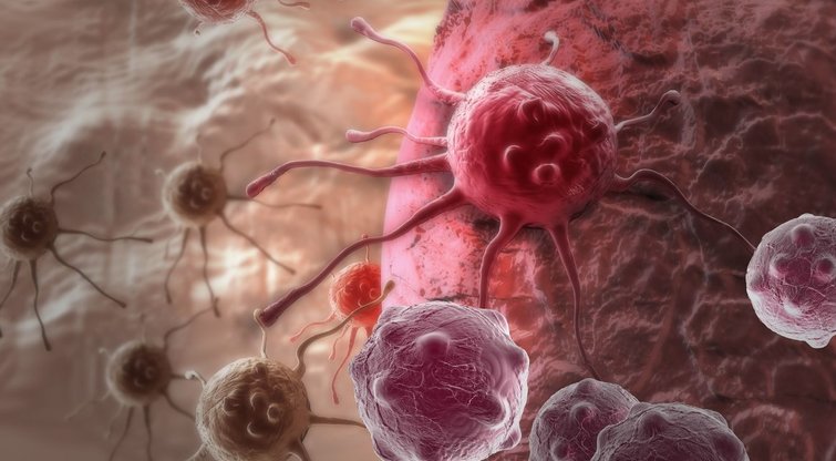 Skrandžio vėžys  (nuotr. 123rf.com)