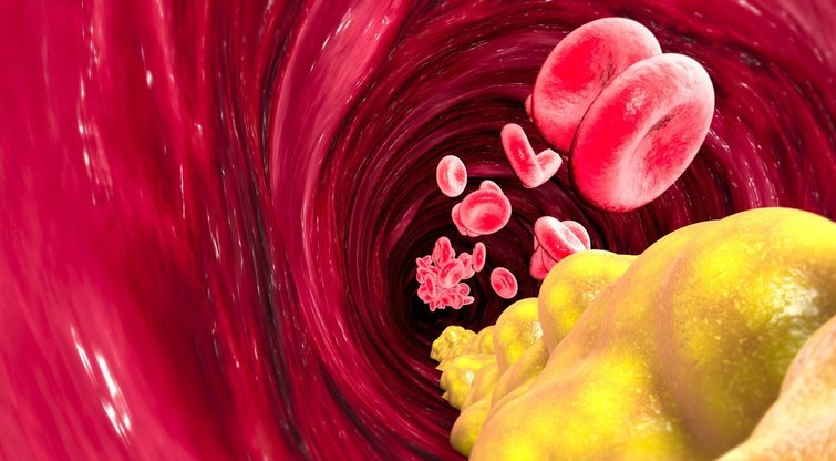 Įspėja turinčius aukštą cholesterolį: venkite 2 produktų (nuotr. Shutterstock.com)