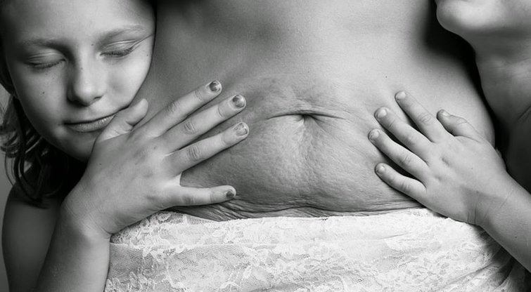 Štai kaip atrodo moters kūnas po gimdymo (viral-posts.com)  