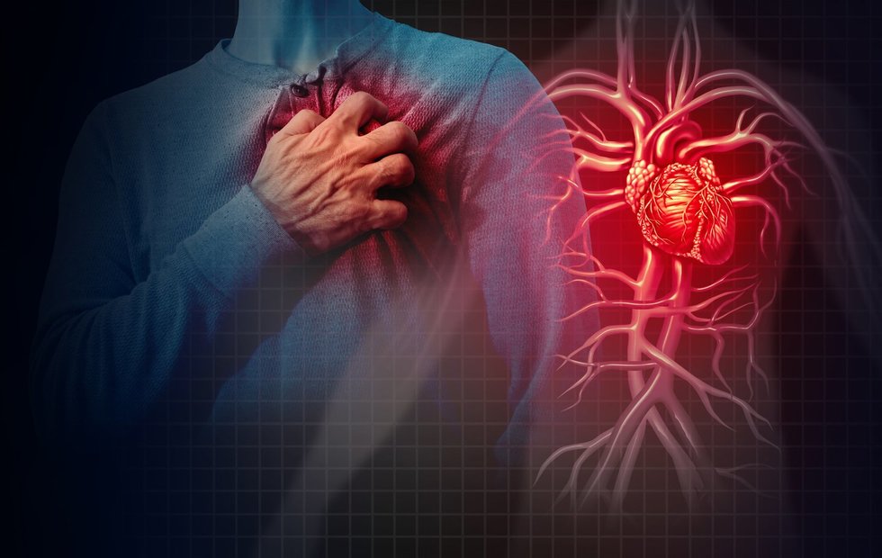 Širdies priepuolis, infarktas (Nuotr. 123rf.com) 