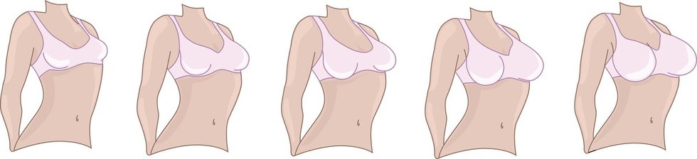 Krūtų dydžiai (nuotr. Fotolia.com)
