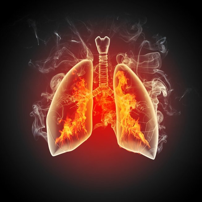 Plaučiai, asociatyvi nuotrauka (nuotr. 123rf.com)