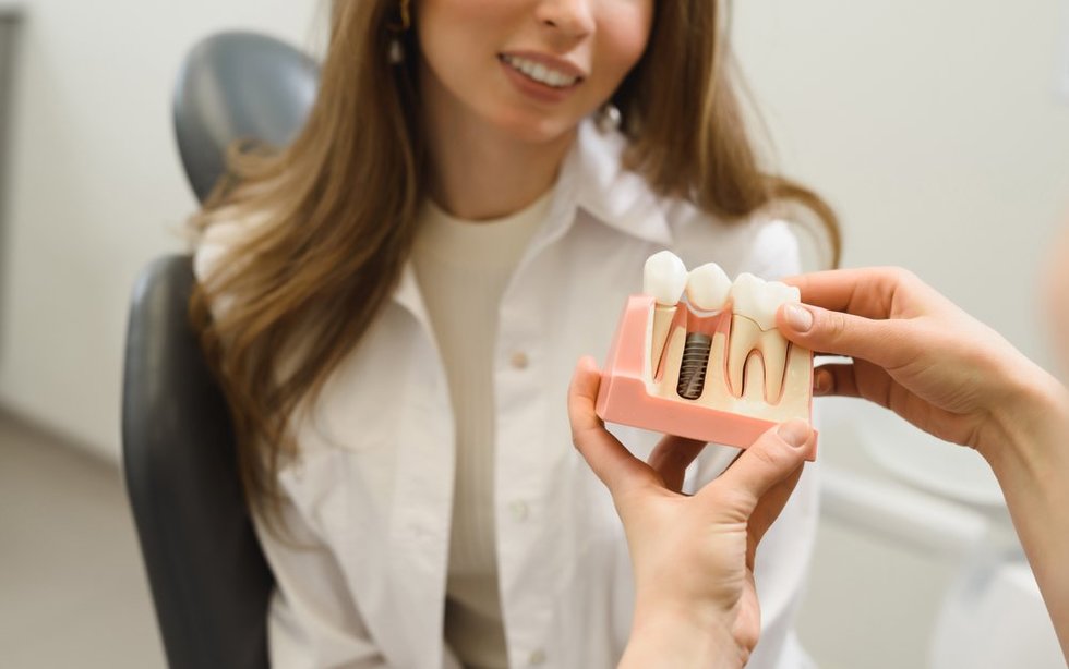 Paaiškino, kuo dantų implantai pranašesni už įdedamus protezus: svarbu nedelsti