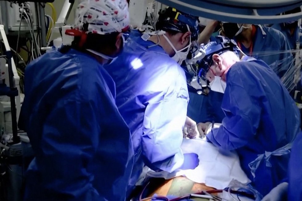 JAV chirurgai atliko istorinę operaciją: žmogui sėkmingai persodinta kiaulės širdis (nuotr. stop kadras)