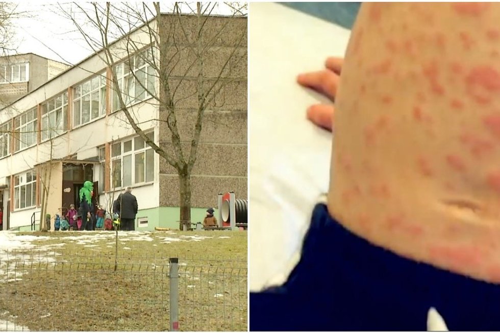 Pavojinga liga nusitaikė į Vilniaus darželinukus   