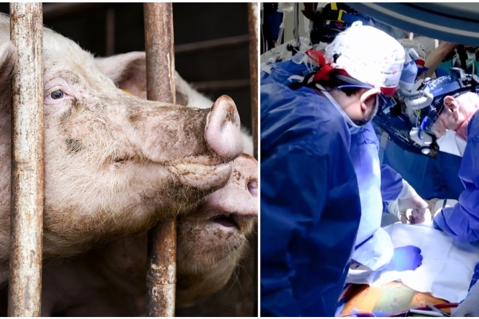 JAV chirurgai per istorinę operaciją žmogui persodino genetiškai modifikuotą kiaulės širdį (tv3.lt koliažas)