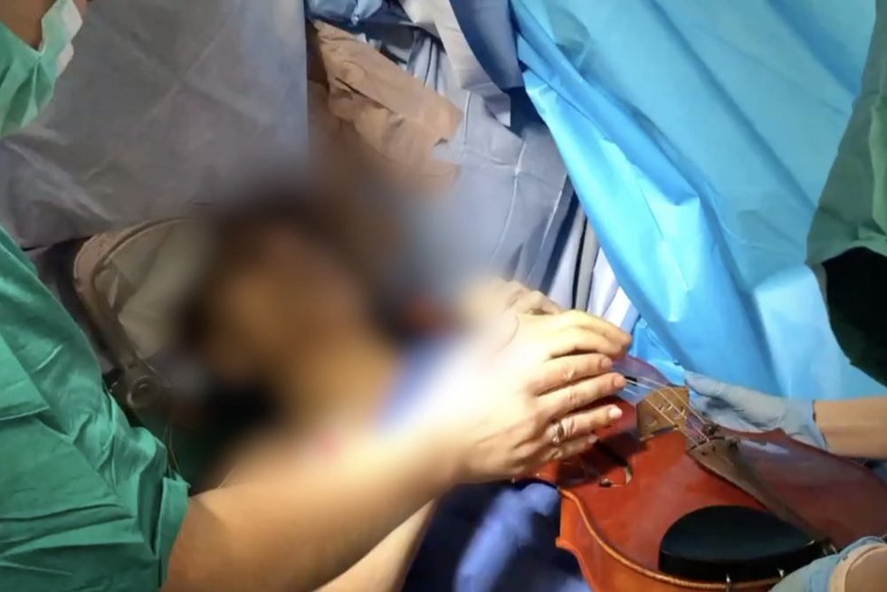 Išskirtiniai vaizdai iš operacijos Santaros klinikose: šalinant auglį smegenyse pacientas grojo (nuotr. stop kadras)